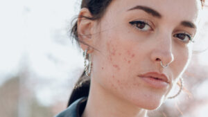FLR_SensitiveSkin_01-1