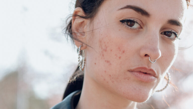 FLR_SensitiveSkin_01-1
