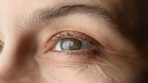 eyes