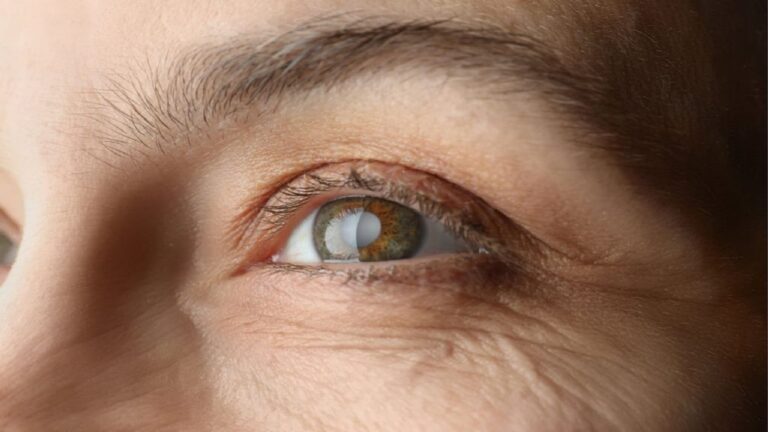 eyes