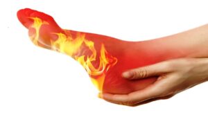 burning_feet