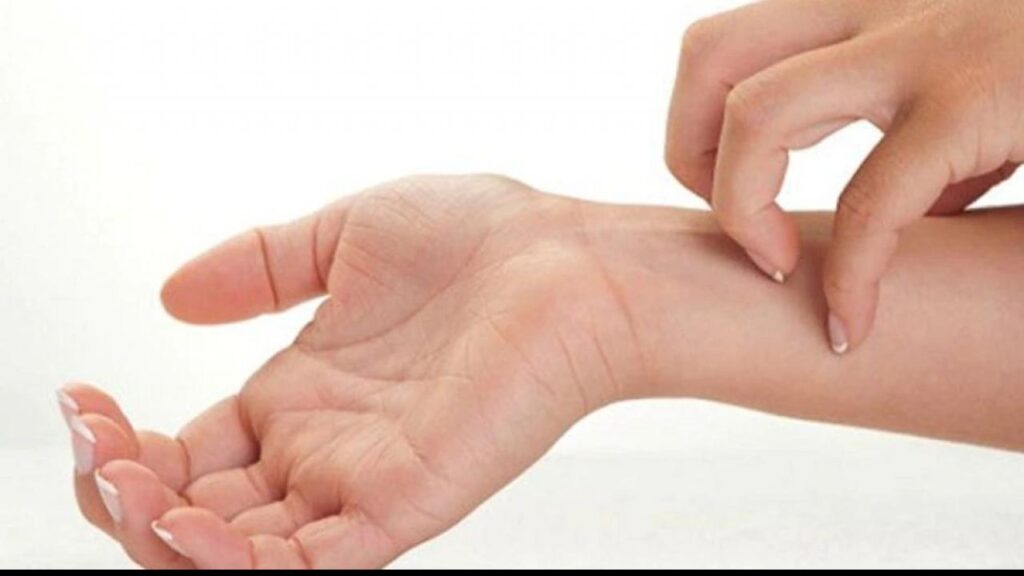 itching-1