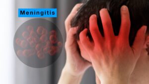 meningitis