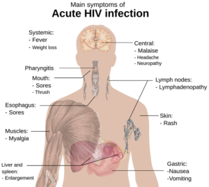 hiv